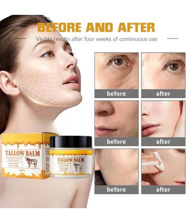 Tallow Honey Balm Tallow Moisturiser Firming Face Cream Face Moisturiser for Whole Body Face Hand Leg Face Cream for Women Skin Tightening Cream for Face Day Cream Anti Wrinkle Face Cream for Dry Skin - Buy Online on GoSupps.com