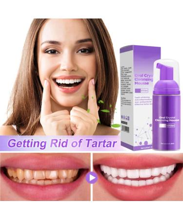 GFOUK Oral Crystal Cleansing Mousse - Tooth Whitening & Purple Color Corrector Booster (3PCS) | Refreshing Breath Deep Clean - Shop Internationally - Buy Online on GoSupps.com