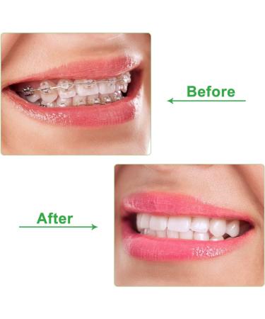 Buy Bobozhong Aligner Chewies 2PCs Silicone Orthodontic Bite Helpers for Invisible Braces Care - Buy Online on GoSupps.com