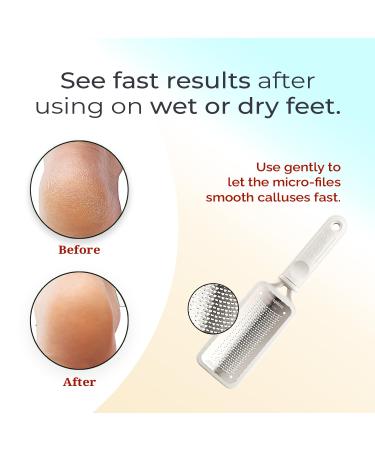 Microplane Colossal Pedicure Rasp Foot File - White | Exfoliating Foot Care Tools - International Shipping Available - Buy Online on GoSupps.com
