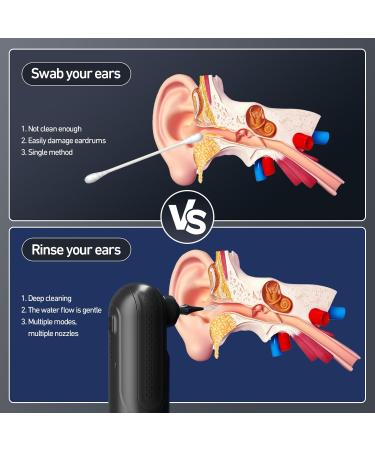 Effective Ear Wax Removal Tool | Electric Water-Powered Ear Cleaner Kit with 10 Tips | Waterproof & Rechargeable - Buy Online on GoSupps.com