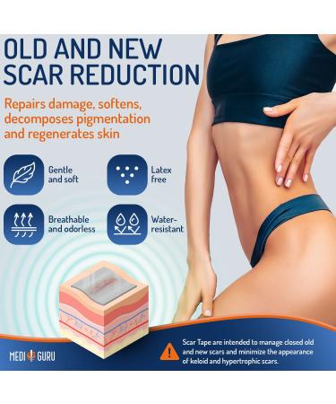 Premium 1.6x120 Silicone Strips for Scar Healing | Advanced Silicone Scar Tape for Surgical Scars - Scar Care Solution - Buy Online on GoSupps.com