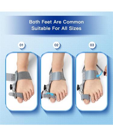 Zeetan Bale Toe Corrector - Adjustable Button Orthopedic Large Toe Relief with Heel Straps - Comfortable Foot Care Solution - Buy Online on GoSupps.com