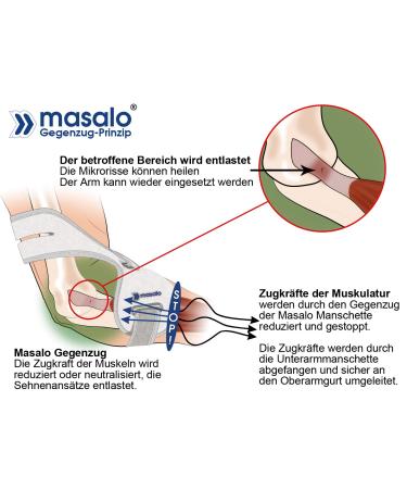 Masalo Cuff MED for Tennis Elbow & Golfer's Elbow - Size 2 Left Arm | International Shipping Available - Buy Online on GoSupps.com