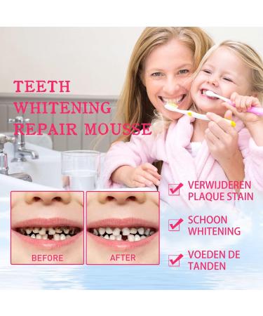 Kids Foaming Toothpaste - Fruit Flavor Press-Type Toothpaste for Children's Teeth Cleaning Whitening & Repair Gentle & Non-Irritating(#1 3PCS) 3PCS #1 - Buy Online on GoSupps.com
