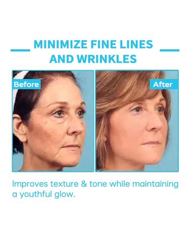 AEEHFENG Lovilds Skin Tightener Advanced Firming & Wrinkle-Reducing Cream Lovilds Skin Firming Rejuvenating Cream Skin Firming Moisturizing and Anti-Wrinkle for all Skin Types (1 Bottle) - Buy Online on GoSupps.com