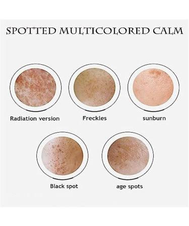  JPSDOWS Whitening Freckle Cream - 20g Anti-Freckle Cream Anti-Plant Cream - Buy Online on GoSupps.com