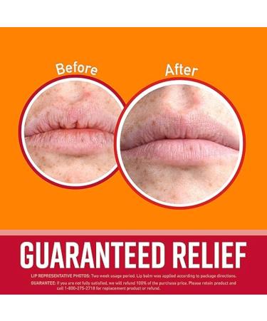 Buy O'Keeffe's Cherry Lip Balm with Vitamin E Oil | 0.15 oz - Intense Lip Repair for Soft Healthy Lips | Fast International Shipping - Buy Online on GoSupps.com
