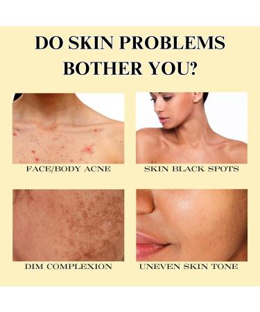 Natural Ginseng Soap Bar Anti-acne Handmade Soap Face Soap Bar Moisturising Body Soap Bar Refreshing Cleansing Soap Bars Cleaning Bars of Soap for Hand Wash & Body Oil Control Bath Soap - Buy Online on GoSupps.com