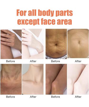 KOAHDE Moisturizing Repair Serum with Retinol Body Smoothing Serum Anti Wrinkle Smoothing Serum B-Glossy Smoothing Body Serum Body Serum Reduce Fine Lines Body Smoothing Essence Body Repair Serum - Buy Online on GoSupps.com