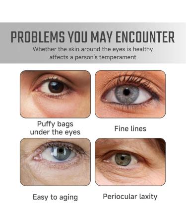 Lutein Eye Essence Oil Eye Serum Oil Solution Roll Ball Lutein Essential Oil Vc Lutein Eye Essence Oil Lutein Eye Serum Firming Anti-Aging Eye Serum for Eye Bags Dark Circles (2) - Buy Online on GoSupps.com