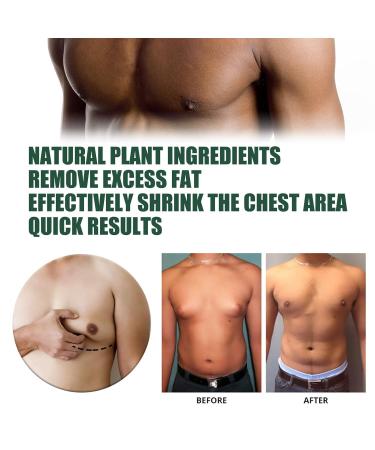 Gynecomastia Cream | Natural Ginger Formula for Men | Chest Tightening and Shrinkage | Safe Daily Use - Buy Online on GoSupps.com