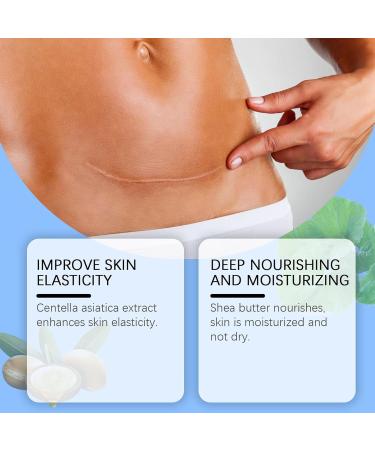 Scar Removal Fade Stretch Marks 30g Gel Reduces Stretch Marks Keloids Surgical Wounds Injuries Cesarean Section New and Old Scars - Buy Online on GoSupps.com
