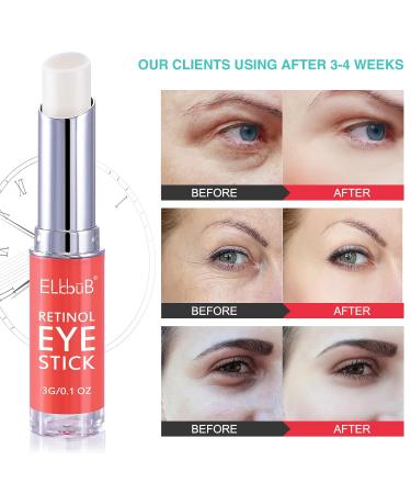 VRTDHY Retinol Eye Cream - Anti-Aging Reduces Dark Circles & Puffiness | Brightening Eye Cream for Swollen Eyes - 2pcs - Buy Online on GoSupps.com