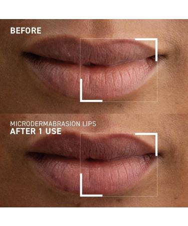 Dr. Brandt Microdermabrasion Smoothing Lip Exfoliator - Polishes & Conditions Dry Flaky Lips to Renew Skin + Prepare for Color Application - 0.35 oz 0.35 Fl Oz (Pack of 1) - Buy Online on GoSupps.com