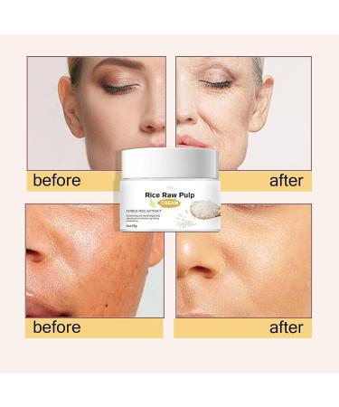 Rice Cream for Skin Turn White Cream of Rice - Face Cream Anti-Aging Moisturizing Nourishing and Hydrating w/Rice Extract for Women - For All Skin Types - Buy Online on GoSupps.com