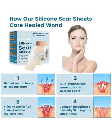 Medical-Grade Silicone Scar Sheets for Surgical Scars, Keloids, and Stretch Marks - 1.6 x 120 inches - Buy Online on GoSupps.com