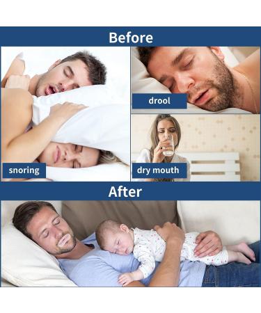 Advanced Gentle Sleep Tape 60 PCS - Mouth Sleep Strips for Improved Nose Breathing and Snoring Relief - Buy Online on GoSupps.com