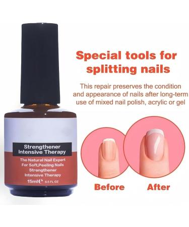 Nail Strengthener for Damaged Nails Nail Strengthener Nail Growth Treatment for Nail Repair Nail Growth and Strengthener Nail Strengthening Treatment Nail Hardener for Damaged Nails Peeling Splits - Buy Online on GoSupps.com