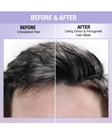 Nykaa Naturals Hair Mask | Deep Conditioner for Dry Damaged Hair | Onion & Fenugreek | 6.76 oz - Suitable for All Hair Types | International Shipping - Buy Online on GoSupps.com