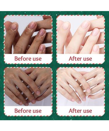  Eazerom 02 Pack of 5 pairs of moisturizing hand masks - Skin repair and renewal - Moisturizing gloves for dry hands - Buy Online on GoSupps.com
