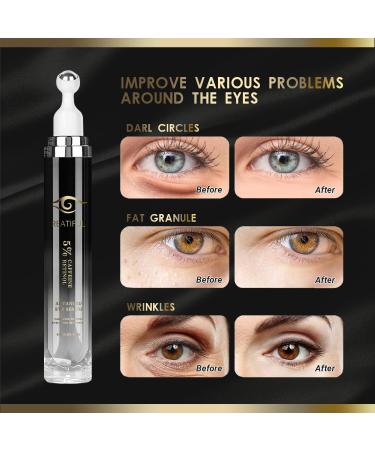 5% Caffeine & Retinol Eye Cream Under Eye Cream for Dark Circles Puffiness Puffy Bags and Wrinkles Fine Lines Anti-Aging Eyes Serum with 360 Roller Massage Ball for Men & Women (1) - Buy Online on GoSupps.com