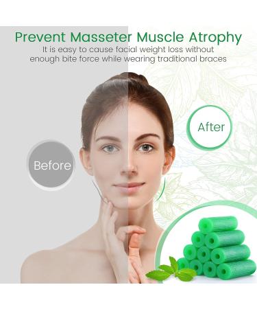 Aligner Chewies for Invisalign - 20 Mint Scented Chewies & 2 Blue Alignment Tools | 22pcs Pack - Buy Online on GoSupps.com