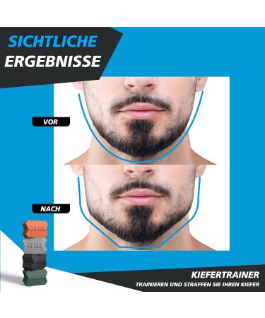 ZAKVOP 8PC Jawline Trainer - 35LB/45LB/55LB/65LB Resistance Levels Pine Jaw Trainer & Neck Exerciser - Doppelkinn Remover | International Shipping - Buy Online on GoSupps.com