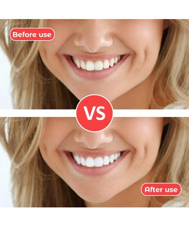 100 Interdental Brushes for Effective Oral Hygiene | Dental Care Tooth Cleaning & Flossing Tools - Buy Online on GoSupps.com