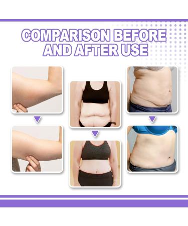  YOENBG Arm Firming Cream - 2025 - New lifting and firming cream for sagging skin - Anti-aging formula to reduce wrinkles and firm skin for a more toned appearance - Buy Online on GoSupps.com