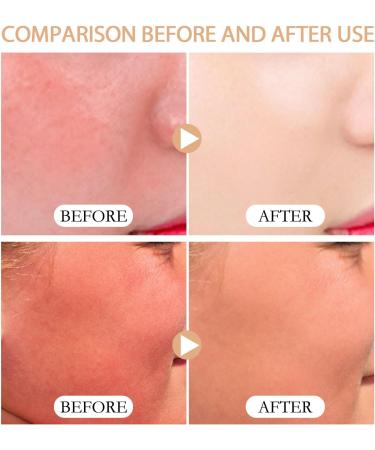 Advanced Sunscreen Spf 50 Face Water Resistant & Non Greasy Face Sunscreen for Body No Fragrance UVA & UVB Protection Suitable for Outdoor Travel Tanning - Buy Online on GoSupps.com