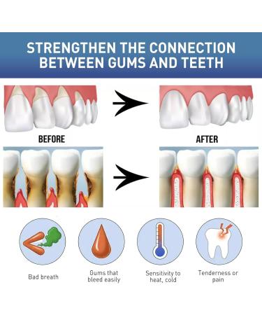 Gum Instant Treatment Gel Gum Instant Soothing Gel Perispot Gum Gel for Teeth Whitening Essence Pen - Buy Online on GoSupps.com