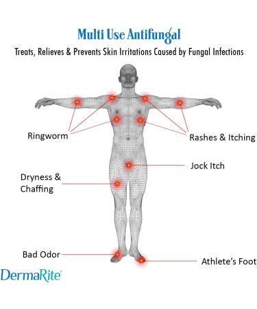 DermaRite Dermafungal Antifungal Cream 2 Pack - 3.75 Oz Tube - 2% Miconazole Nitrate - Treats Athlete's Foot, Jock Itch, Ringworm and Itchy Skin - Latex Free, Dermatologist Tested - Buy Online on GoSupps.com