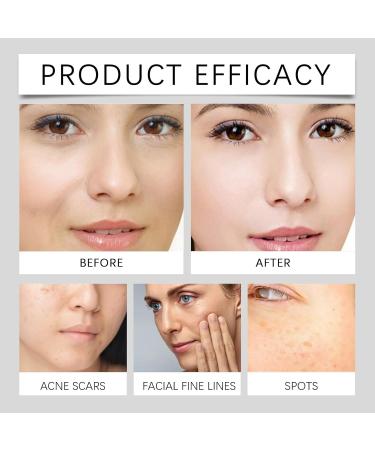 Whitening and freckle removal vitamin C face cream dark spots correction cream brightening and pigment color removal cream antispots serum magic cream to soothe and repair - Buy Online on GoSupps.com