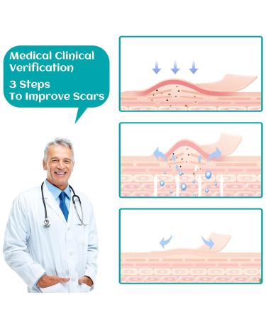 Invisible Silicone Scar Sheets 1.6x60 Roll - Soft, Breathable & Waterproof Gel for C-Section & Body Scars - Buy Online on GoSupps.com