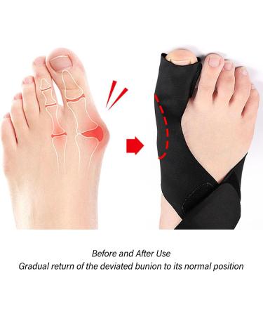 Bale Corrector for Women & Men | Adjustable Bale Bandage & Cushion | Prevent Slipping & Shock-Damping | Large Toe Separator for All-Day Comfort - Buy Online on GoSupps.com