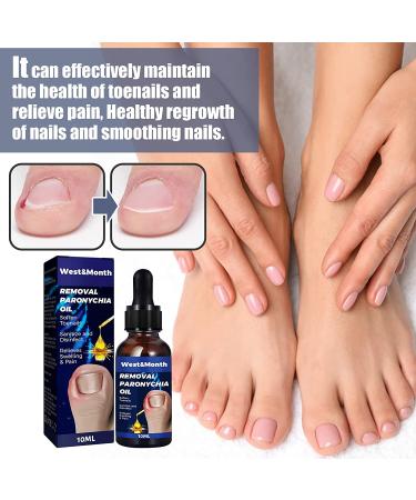 3PCS German Toenailcare Removal Paronychia Oil Treatment & Relief for Healthy Toenails - Buy Online on GoSupps.com