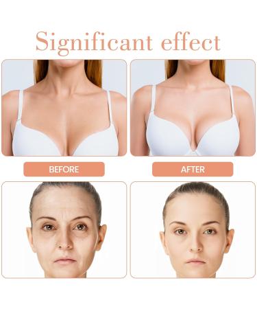 Forehead Wrinkle Patches - Anti-Wrinkle Silicone Pads Set for Fine Lines | 12 Sheets for Women & Girls - Buy Online on GoSupps.com