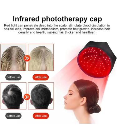 Bonnet De Repousse des Cheveux Lumi Re Rouge Bonnet De Repousse Rapide des Cheveux Double Longueur d'onde 660nm Et 850nm 3 Modes avec 120 LED pour La Perte De Cheveux Black Noir - Buy Online on GoSupps.com