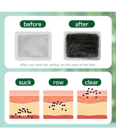 40PC Ginger Foot Pads | Deep Cleansing Foot Patches for Stress Relief Improved Sleep & Relaxation - International Shipping Available - Buy Online on GoSupps.com