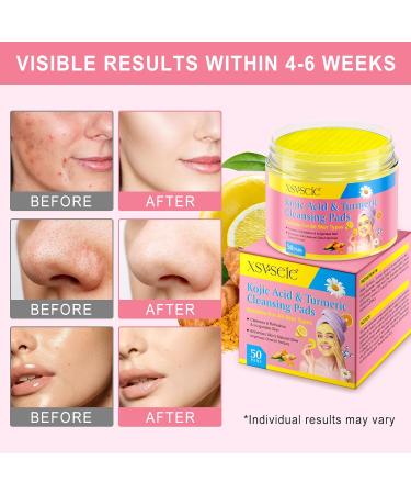  Feeliville Turmeric Pads Kojic Acid & Turmeric Pads Infused Foaming Exfoliating Pads for Dark Spots Dull Skin Unclog Pores Help Balance Skin Oil and Water (2  - Buy Online on GoSupps.com
