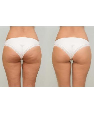 LuxeJoie Cellulite Recovery Cream 21-Day Challenge for Booty, Hips & Thighs - 4oz - Buy Online on GoSupps.com