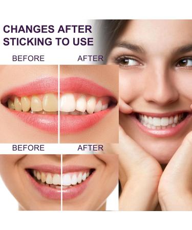 V34 Purple Toothpaste - Teeth Whitening Solution | 50ml Stain Removal for Brighter Smiles - Buy Online on GoSupps.com