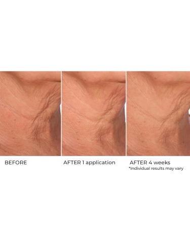 Age Defying Neck & Decollete Treatment Serum - Firm & Tighten Sagging Skin | Best Neck Wrinkle Serum - Buy Online on GoSupps.com