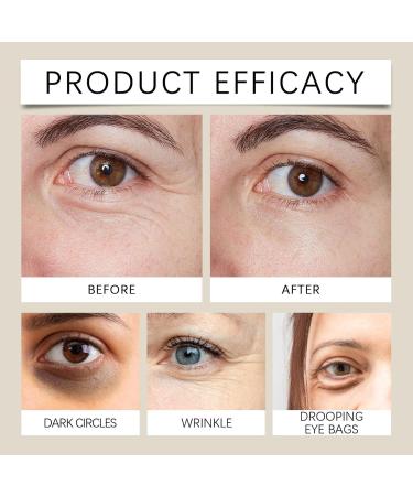 Castor Oil and Frankincense Castor Oil for Eyes Castor Oil Castor Oil Castor Oil and Frankincense Oil Eye Roller (3) - Buy Online on GoSupps.com