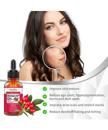 100% Pure Organic Rosehip Oil for Face Hair & Skin - Cold Pressed Anti-Aging Moisturizer Serum (30ml - Buy Online on GoSupps.com
