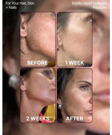 BeMe Liquid Collagen for Women - 2500mg Verisol Collagen Liquid with Biotin CoQ10 & Vitamin C - Clinically Proven Collagen Peptides for Hair Skin & Nails - 30 Peach Sachets Peach 21 Fl Oz (Pack of 1) - Buy Online on GoSupps.com