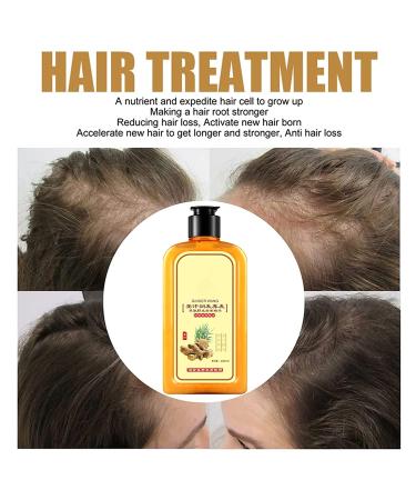 Ginaday Instant Ginger Hair Regrowth Shampoo - Hair Growth & Care Formula, Anti-Hair Loss - 280ML/1PCS (2 Count) - Buy Online on GoSupps.com