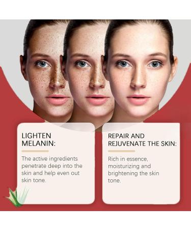 Kojic Acid Cream Dark Spot Remover for Face Skin Lightening Cream for Anti Aging Dark Spot Correcting Glow Serum Face Moisturizer for Women Pigmentation Removal Cream Freckle Removal Cream Dark Spots - Buy Online on GoSupps.com