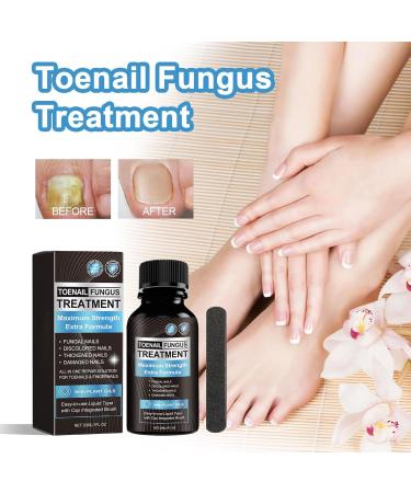 Solution nourrissante pour r paration des ongles des doigts 30 ml Solution de r paration durable pour ongles des orteils pour le bain la maison le salon de p dicure manucure de nuit voyage - Buy Online on GoSupps.com